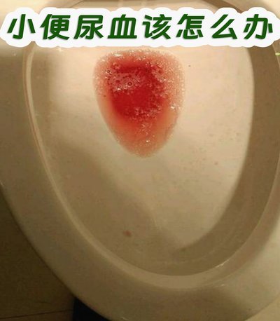 白条带血怎么回事